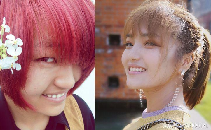 点痣的十大忠告,自己点痣的十大忠告