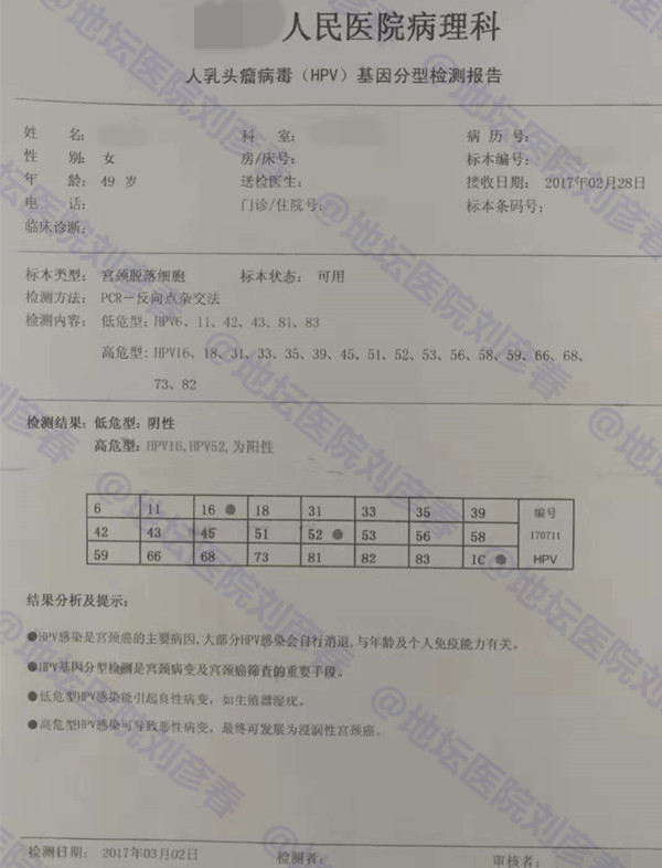 接触性出血是癌症的前兆吗,接触性出血是肿瘤晚期吗