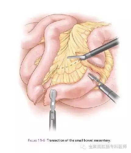 功能性便秘总的治疗原则是个体化,治疗功能性便秘的常用药物
