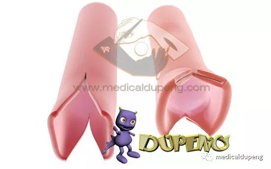 医学插画插图,医学插画sci