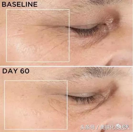 洁面美容仪哪个最好用,洁面美容仪器推荐