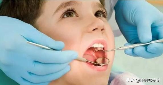 2岁的孩子蛀牙需要补吗,几岁的小孩有蛀牙需要治疗吗