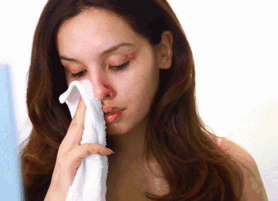 毛孔粗大到底该怎么办,鼻子毛孔粗大有洞怎么办