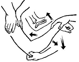 中医骨折治疗原则,中医骨伤整复术