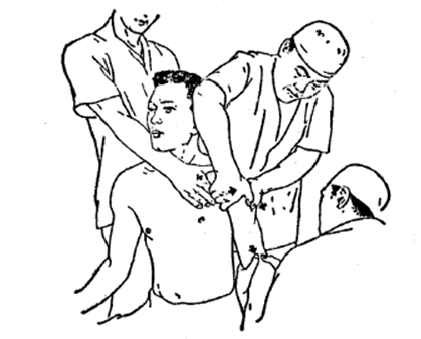 中医骨折治疗原则,中医骨伤整复术