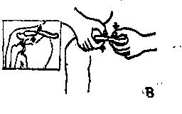 中医骨折治疗原则,中医骨伤整复术