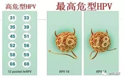 hpv感染到癌需要多久,hpv感染到宫颈癌都经历了哪些