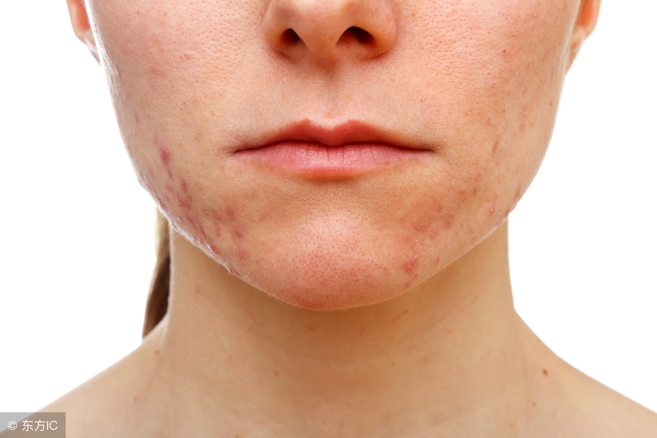 谨慎！小红书上爆红的护肤秘籍，千万别全信！