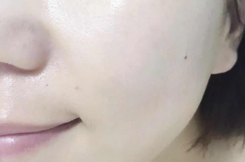 有了全世界3秒卖一瓶的“液体黄金“，干燥、长痘就与你无缘了！