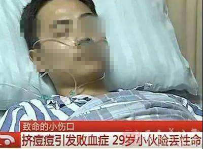 挤痘痘一定要把血挤干净吗,挤痘痘要挤到出血吗