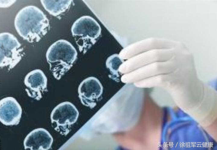 从2例脑血管疾病后遗症的康复,谈其综合理疗调理方案的实施