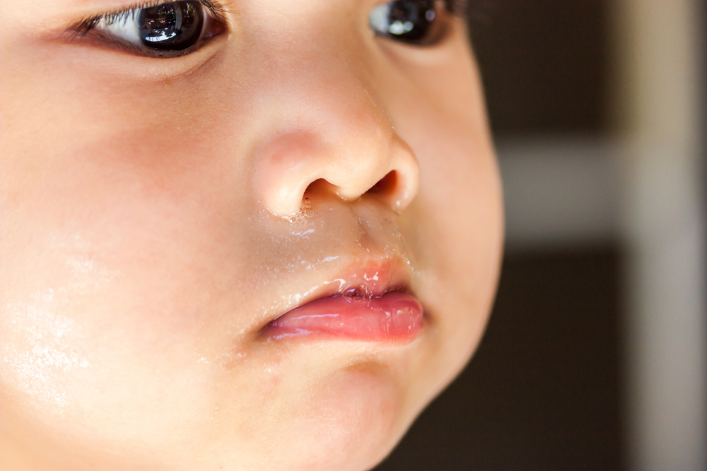 流清鼻涕后转为脓鼻涕,宝宝由清鼻涕变脓鼻涕是怎么回事