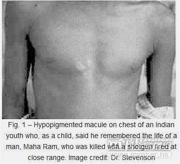 轮回胎记真的有效吗,胎记和轮回