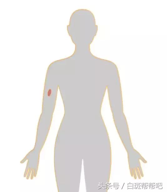 李咏是因为癌症死亡的吗,李咏得的啥癌症为什么葬在美国