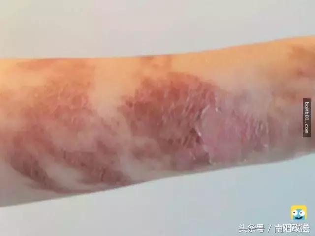 被雷劈是种什么样的体验？看完简直身受同感