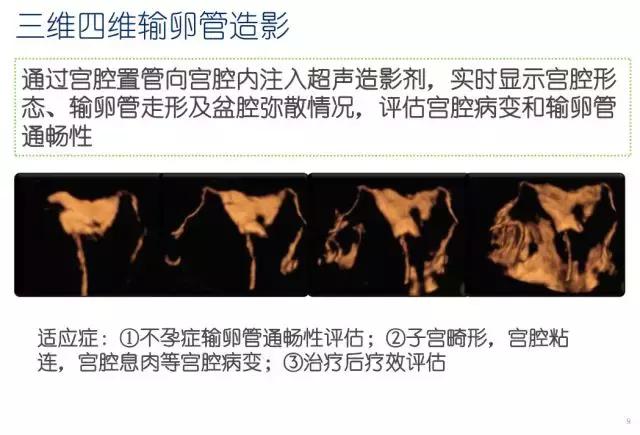 妇科盆腔彩超探头,妇科超声波探头