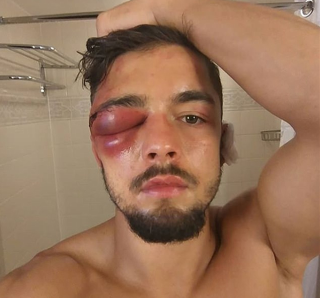 重量级拳击手重拳对普通人的伤害,拳击手的拳力为啥那么大