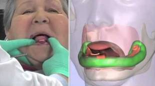 缺牙如何补种牙,缺牙补牙齿的步骤