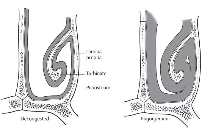 感冒鼻塞一边堵一边通怎么回事,为什么鼻塞的时候经常堵一边