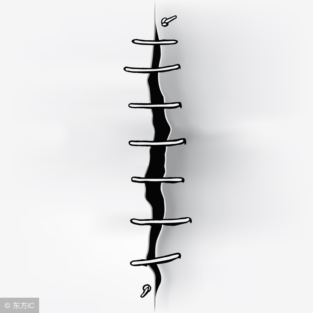 剖腹产后瘢痕增生多久能生二胎,第一胎顺转剖腹产的疤痕怎么恢复