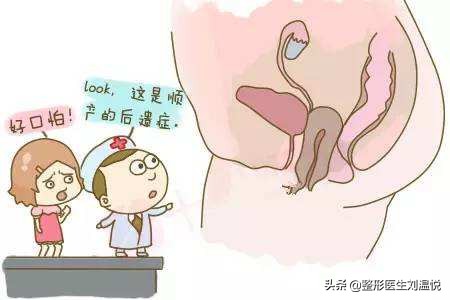 女性生完孩子一定要做盆底修复吗,年轻女人最后悔的功课
