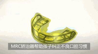 mrc肌功能矫正,mrc肌功能训练操