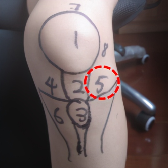 膝盖痛12种疼痛对照表图解,不同部位膝盖疼痛的原因