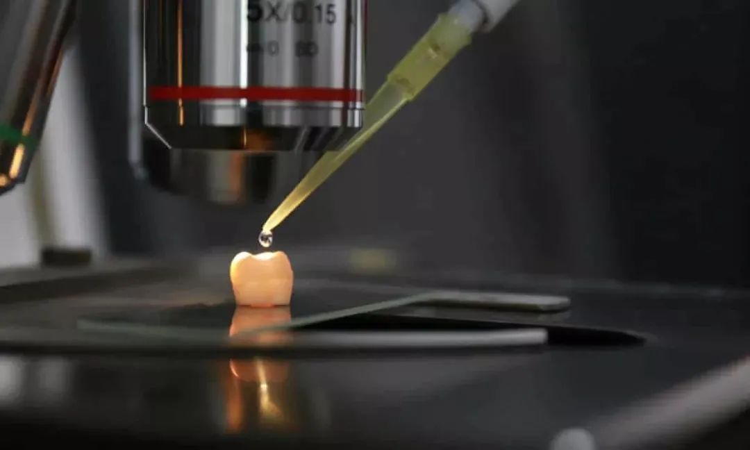 前沿洞察丨滴滴一下修补牙齿超方便