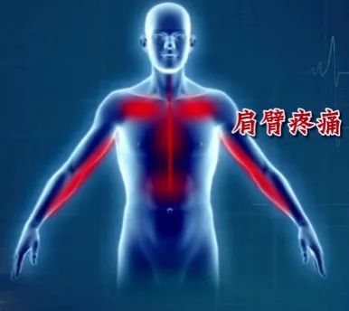 没有征兆而突发心梗有多可怕,哪些地方疼会是心梗的前兆