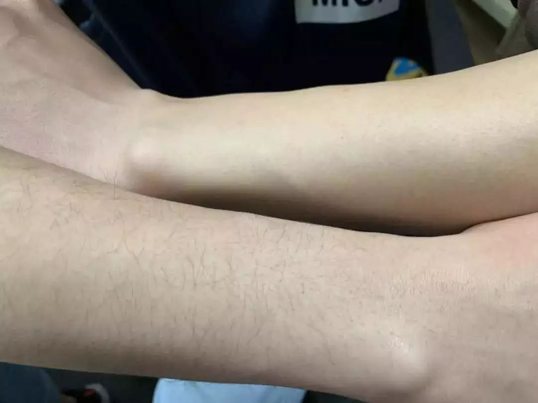 脱毛的方法不花钱,脱毛小技巧立马见效