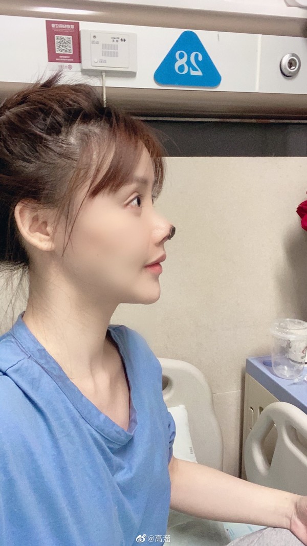 女星高溜整容,演员高溜整容失败欲轻生