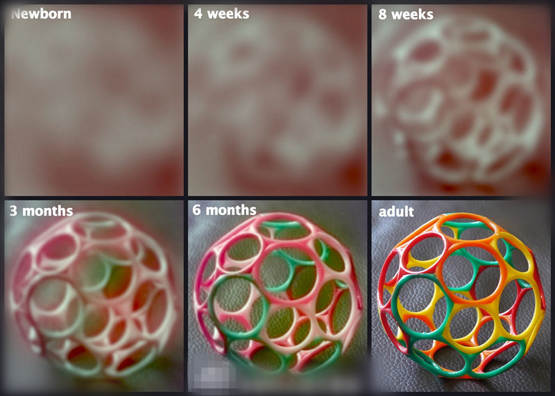 新生儿怎么预防眼睛有斜视,为什么新生儿看人都斜眼