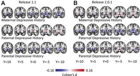 心智化失能介导童年期情感虐待与成年期抑郁症症状的联系