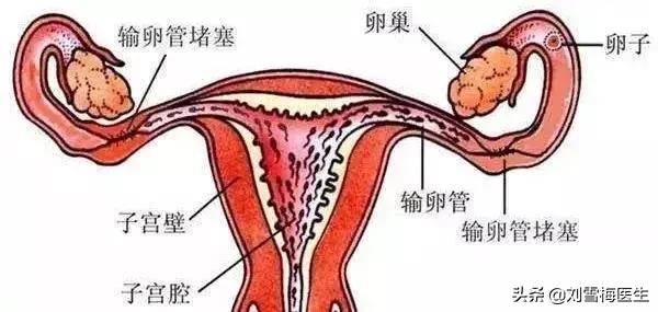 宫外孕怎么备孕防止再次宫外孕,得过宫外孕后要怎样备孕