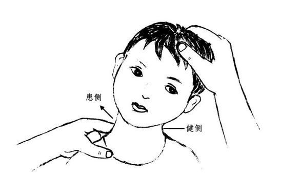 孩子总是歪头看电视,孩子总是歪头睡怎么办