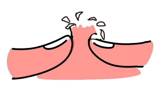 为啥不能挤痘,为什么不能挤嘴上的痘痘