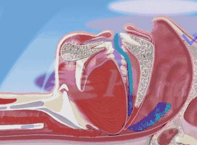 新冠肺炎重症用的机器,机械的力量