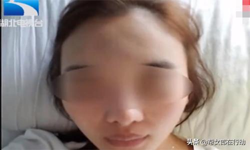 整容做成了朝天鼻,整容变朝天鼻