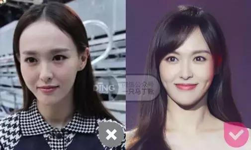 颅顶太低如何自救,颅顶低怎么自救