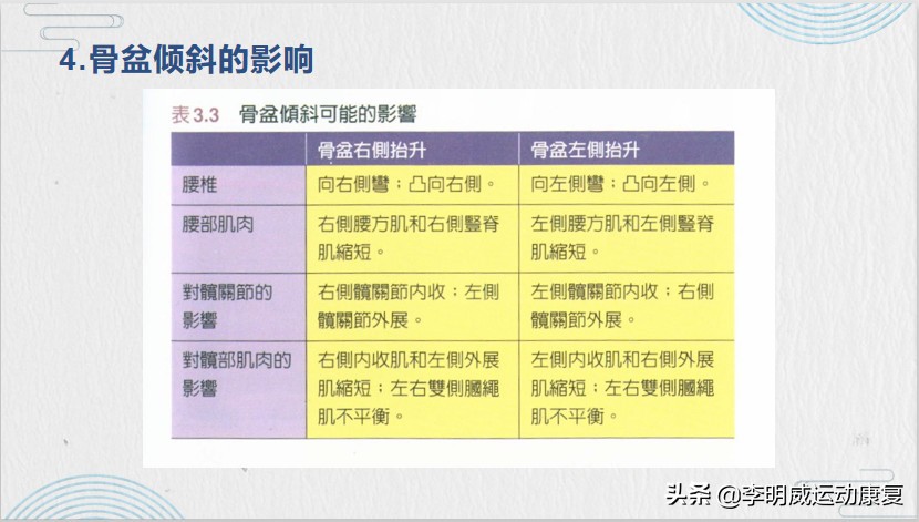 骨盆侧倾的治疗方法,骨盆侧倾最佳的矫正方法