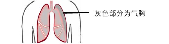 剧烈咳嗽呼吸困难上不来气,咳嗽多痰呼吸困难有哮鸣音