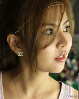 18岁土肥圆豪掷800万全身整形，鼻子6次大整假体穿出，效果却超美