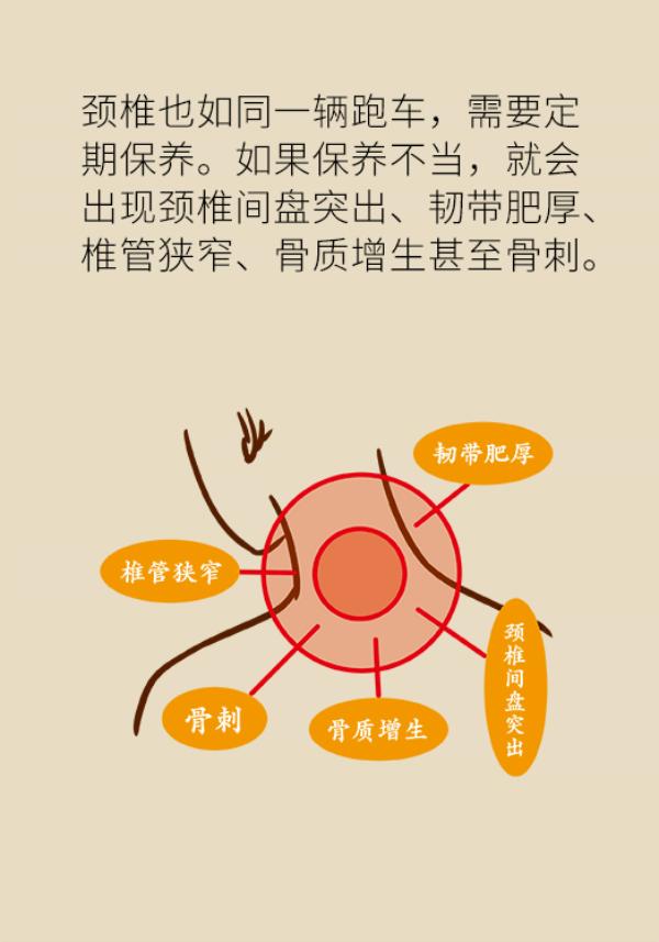 颈椎脖子僵硬紧绷感酸痛缓解方法,睡醒后脖子僵硬酸痛怎么缓解