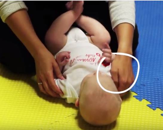 纠正宝宝斜颈最好的办法,宝宝斜颈要做什么操可以缓解