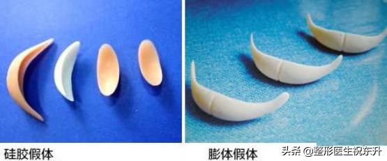 下巴假体好还是注射玻尿酸好,下巴是假体好还是玻尿酸好