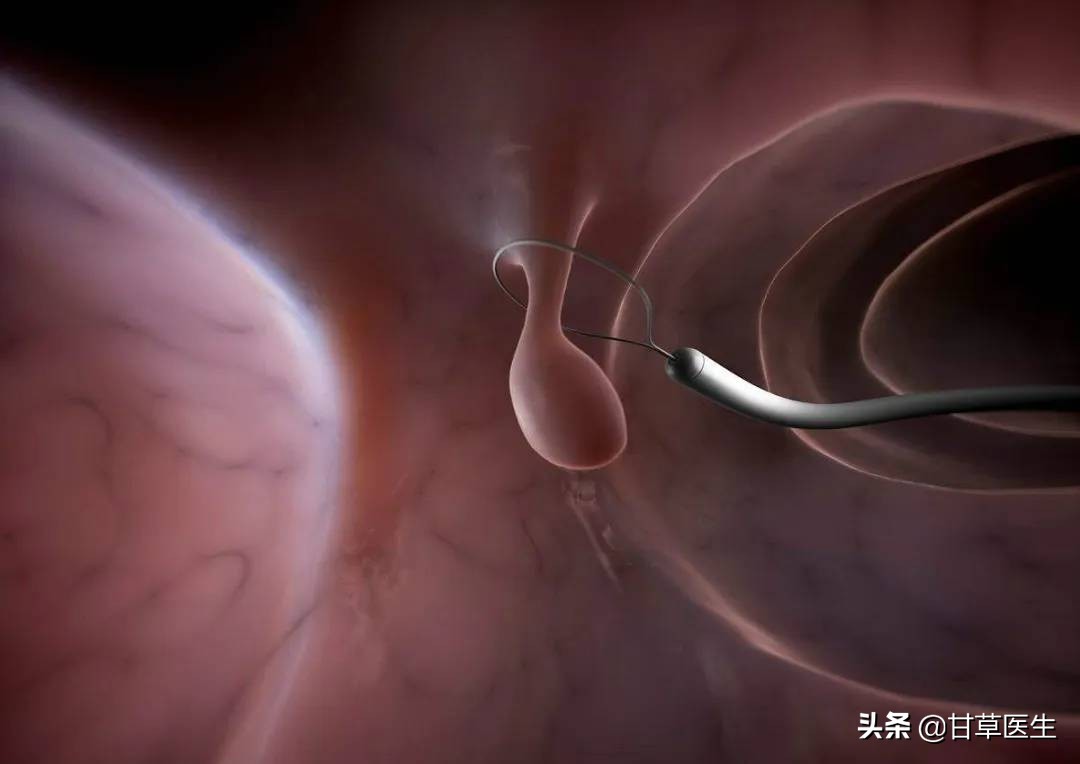 发现硬块是什么原因,发现包块是癌症晚期吗