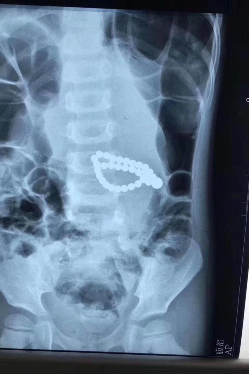 能量石核辐射超标112倍致癌,核辐射超标112倍能量石保平安