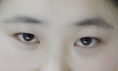 双眼皮有几种做法呢,双眼皮贴有几种玩法