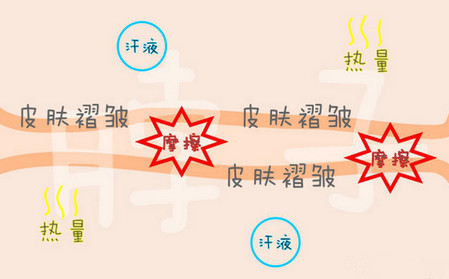 宝宝淹脖子哭闹不止，竟是奶奶惹的祸，这种错误别再犯了