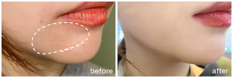 用绵羊油护肤皮肤竟如此水润饱满,莱蔻澳洲绵羊油多效水润嫩肤霜